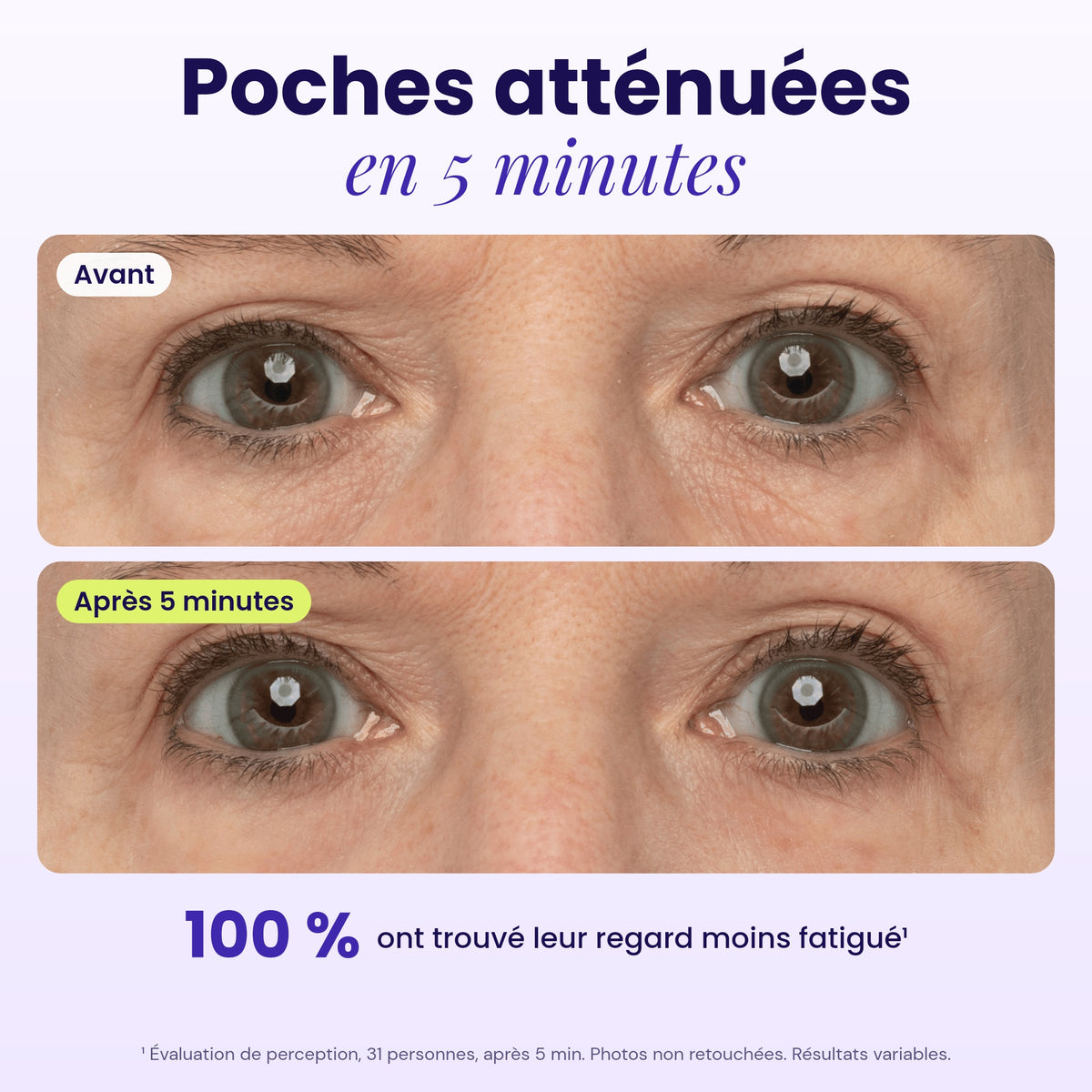 Avant / après 5 minutes : poches atténuées, 100 % ont trouvé leur regard moins fatigué