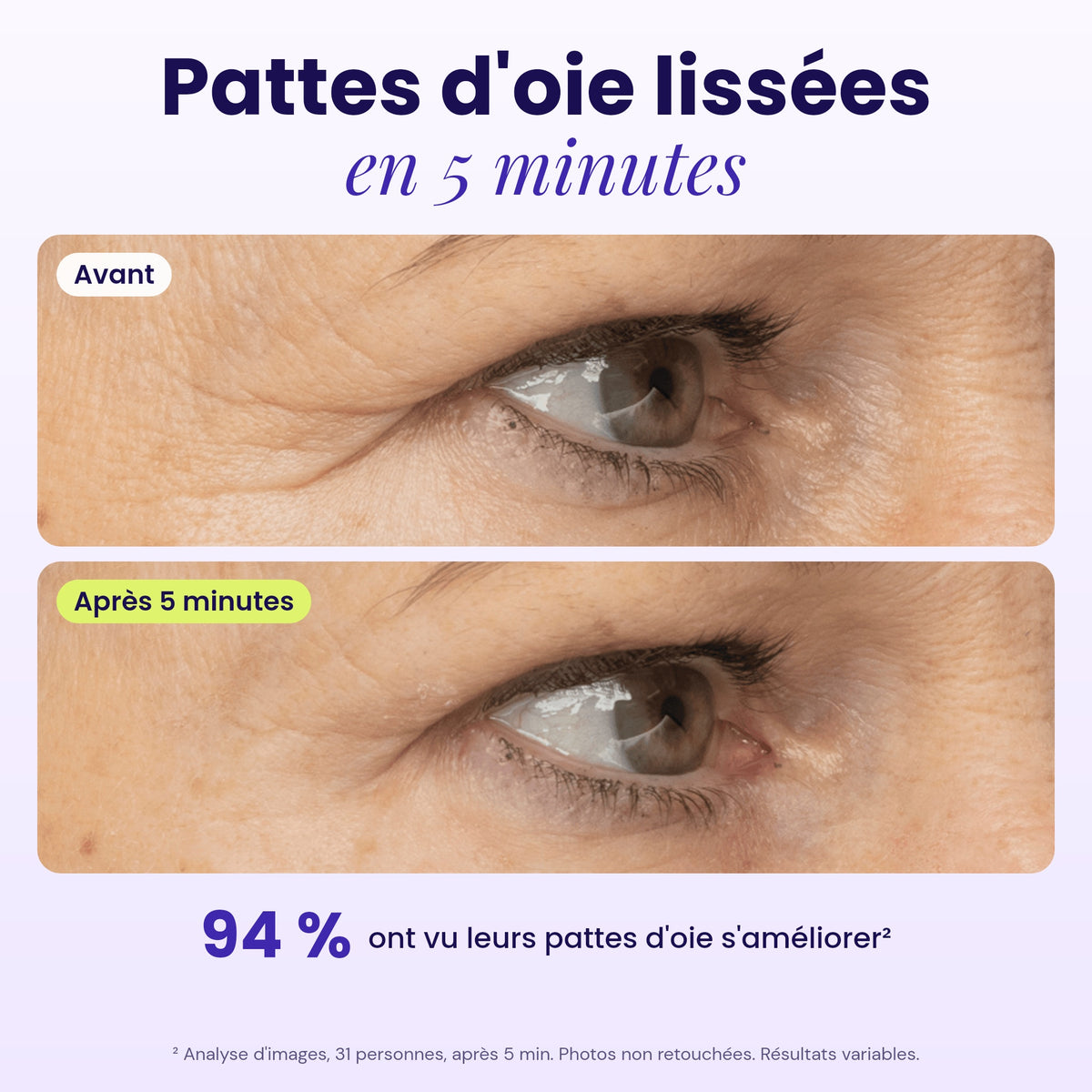 Avant / après 5 minutes : pattes d'oie lissées, 94 % ont vu une amélioration