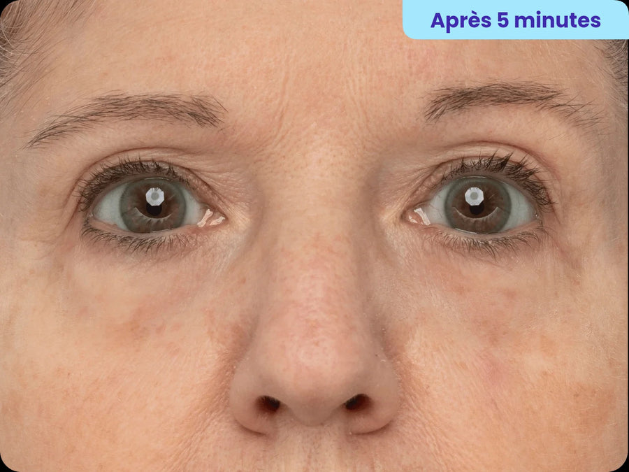 Après 5 minutes