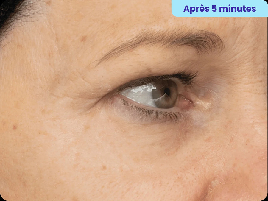 Après 5 minutes